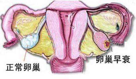 怀孕去香港验血几多费用,卵巢早衰，26岁的女孩提前进入更年期，备孕4年未怀