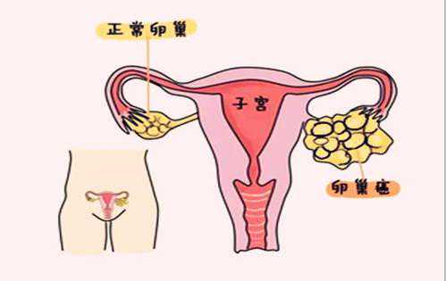 孕9 2香港验血13个D2个ND,不知不觉就怀不上了？附最全男女不孕不育排查方法