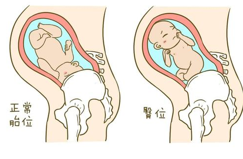 香港验血冯淑仪诊所怎么样,女性备孕期间吃什么促排卵？