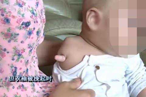 香港验血机构正规,第三代试管婴儿可以避免哪些遗传病？