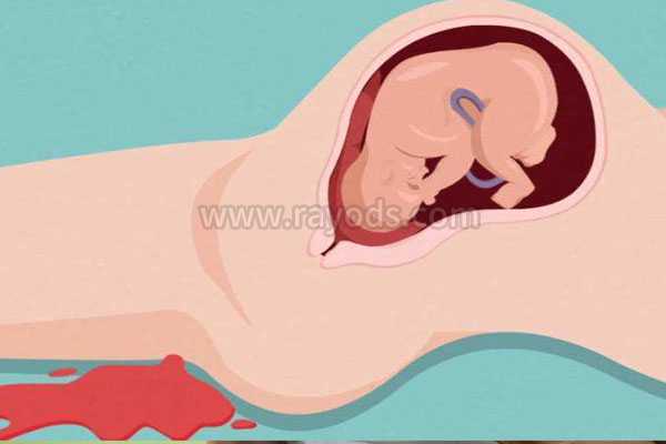 怀孕香港验血能看出男女吗,这三种行为是导致女性不孕不育原因,女性不孕11步