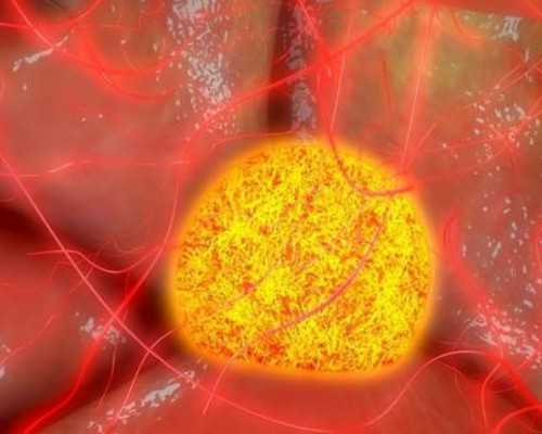 临沂供卵费用与滨州供卵服务解析