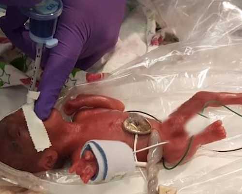 莆田试管婴儿技术发展与现状解析