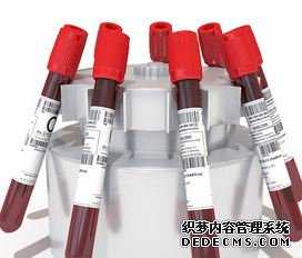 香港验血检测男女邮寄_香港验血官网查询几周是最准呢？
